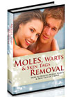 Moles, Warts & Skin Tags Removal