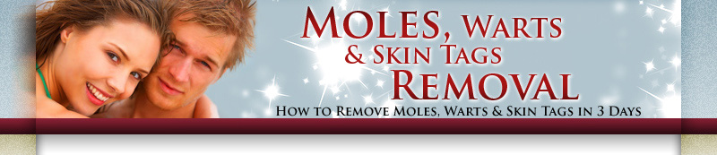 Moles, Warts & Skin Tags Removal