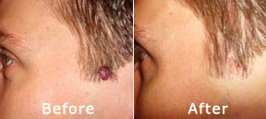 Brian - Before & After